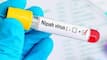 Nipah Virus Outbreak in Kerala: 3 Risk Factors That Increase Severe Infection